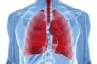 При приведенні діагностики рак легень можливо переплутати з коронавірусною пневмонією