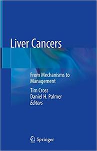Liver Cancers From Mechanisms to Management