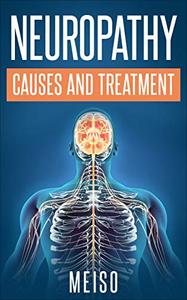 Neuropathy Causes and Treatment