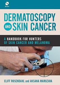 Dermatoscopy and Skin Cancer A handbook for hunters of skin cancer and melanoma