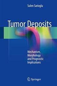 Tumor Deposits Mechanism, Morphology and Prognostic Implications 