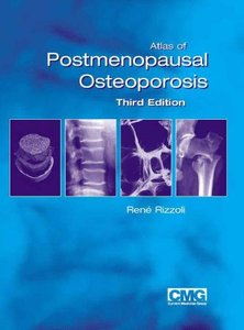 Atlas of Postmenopausal Osteoporosis, 3rd Edition
