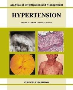 Hypertension An Atlas of Investigation and Management