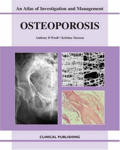 Osteoporosis An Atlas Of Investigation And Diagnosis