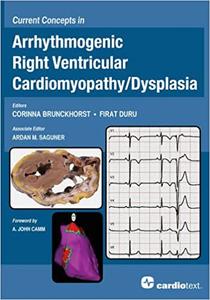 Current Concepts in Arrhythmogenic Right Ventricular Cardiomyopathy  Dysplasia
