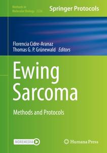 Ewing Sarcoma Methods and Protocols
