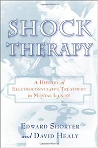 Shock Therapy A History of Electroconvulsive Treatment in Mental Illness