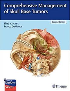 Comprehensive Management of Skull Base Tumors