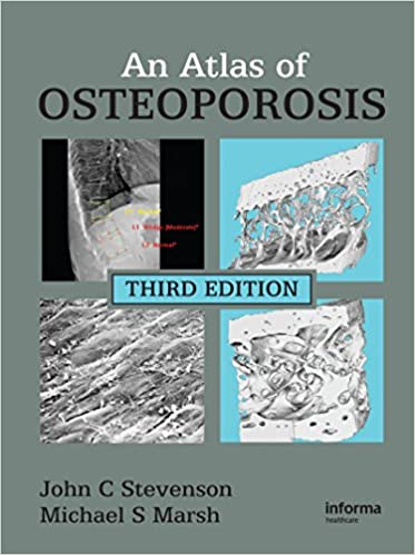 An Atlas of Osteoporosis (Encyclopedia of Visual Medicine Series) 3rd Edition