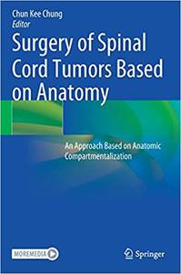 Surgery of Spinal Cord Tumors Based on Anatomy (EPUB)