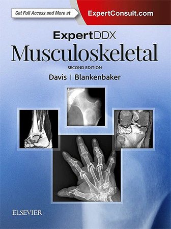 ExpertDDx: Musculoskeletal, 2nd Edition
