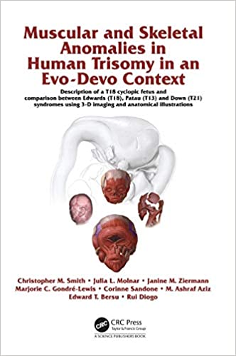 Muscular and Skeletal Anomalies in Human Trisomy in an Evo Devo Context