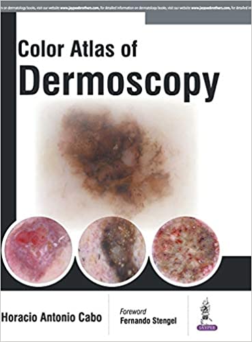 Colour Atlas of Dermoscopy