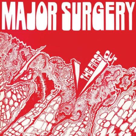 Major Surgery - The First Cut (2013)