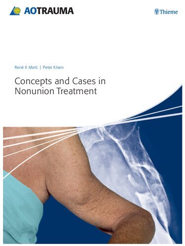 Concepts and Cases in Nonunion Treatment (AO Trauma Handbooks)